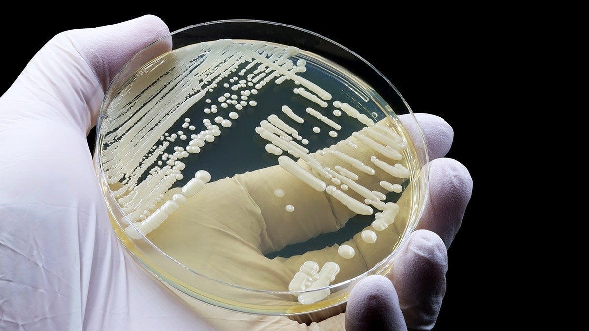 doctor showing a culture of Candida auris